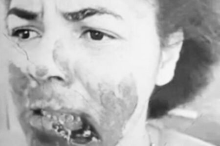 Una mujer muerde y arranca parte del labio de la amante de su esposo en Brasil